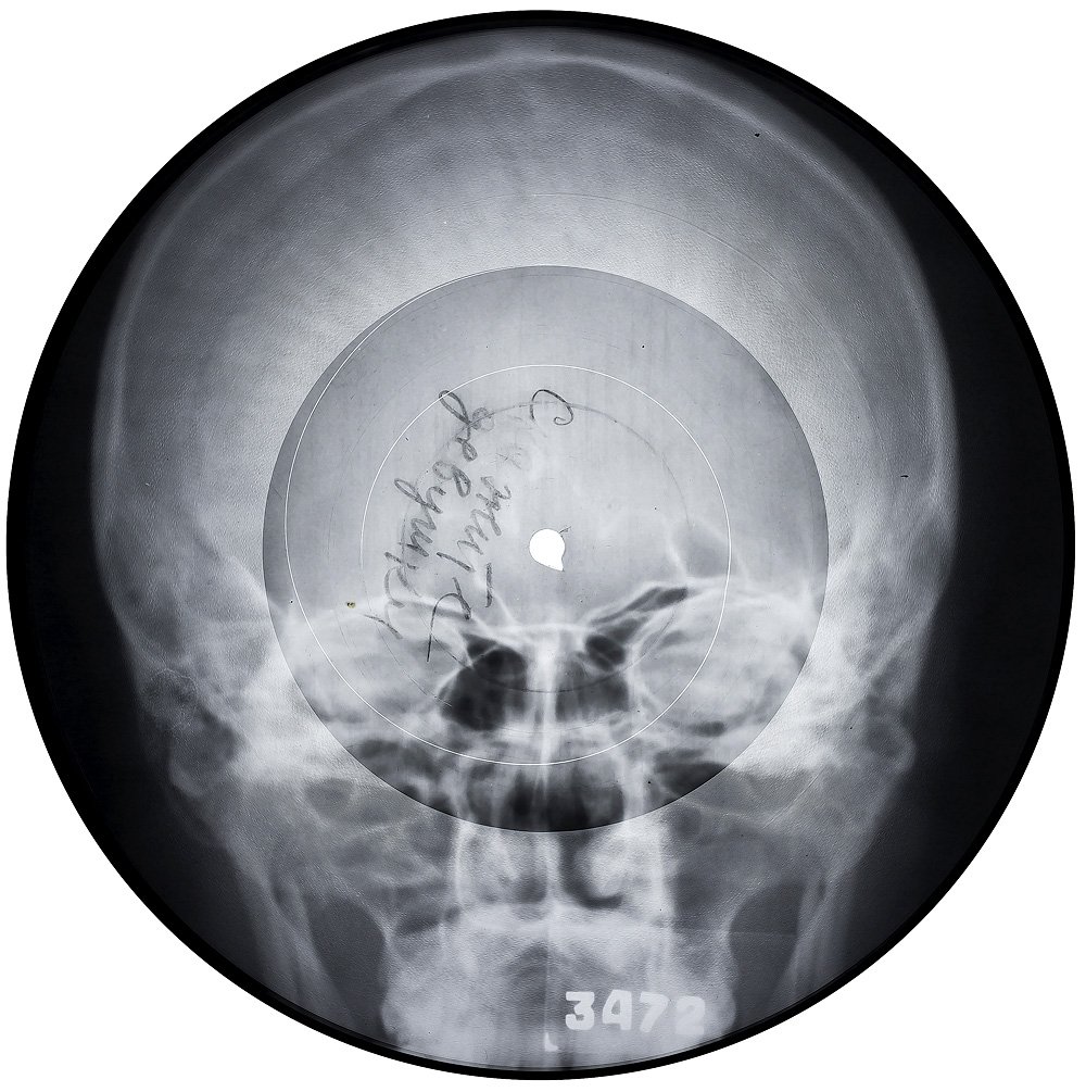 Неизвестный исполнитель. «Скажите девушки». Конец 1950-х — начало 1960-х. Аудиозапись на рентгеновском снимке. Диаметр 22 см. Собрание X-Ray Audio, Лондон