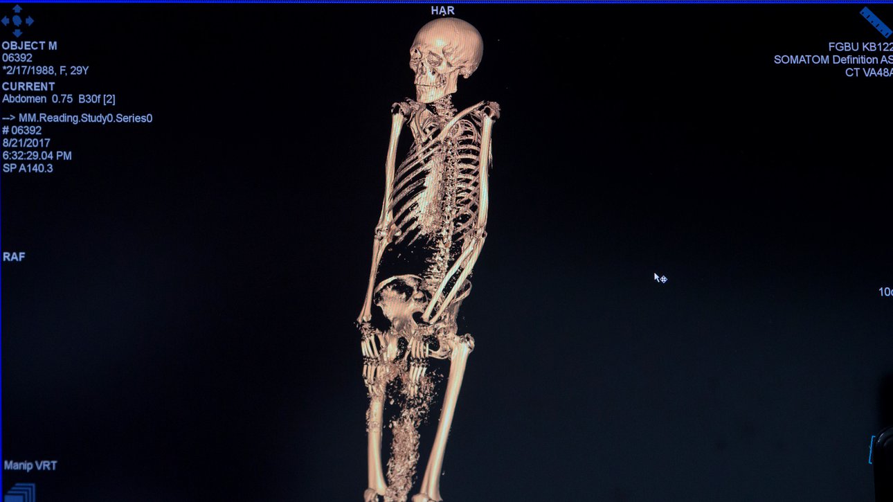 Компьютерная томография древнеегипетской мумии из коллекции Государственного Эрмитажа. Фото: Светлана Рагина / Государственный Эрмитаж