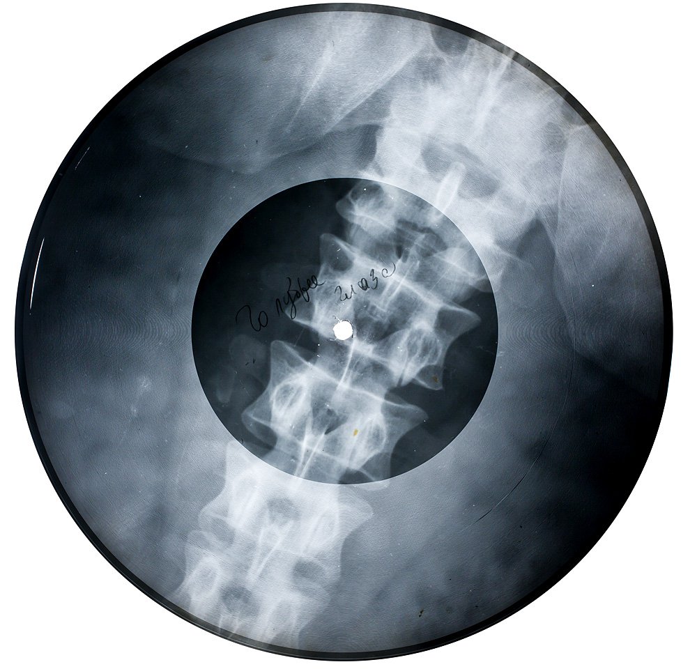 Петр Лещенко. «Черные глаза». 1950-е. Аудиозапись на рентгеновском снимке. Диаметр 22 см. Собрание X-Ray Audio, Лондон
